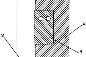 手術(shù)介入鋪單