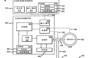 自調(diào)節(jié)胃帶